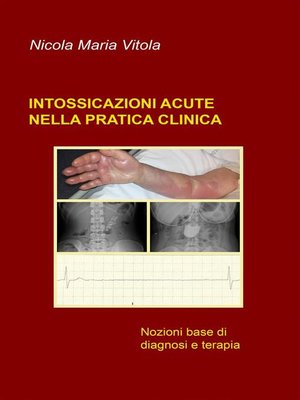 cover image of Intossicazioni acute nella pratica clinica
